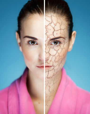 Dry Skin Edmonton
