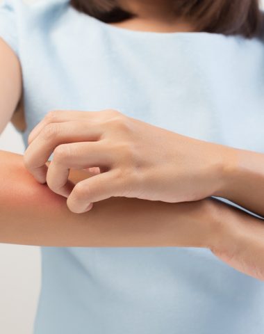 Eczema & Atopic Dermatitis Treatment