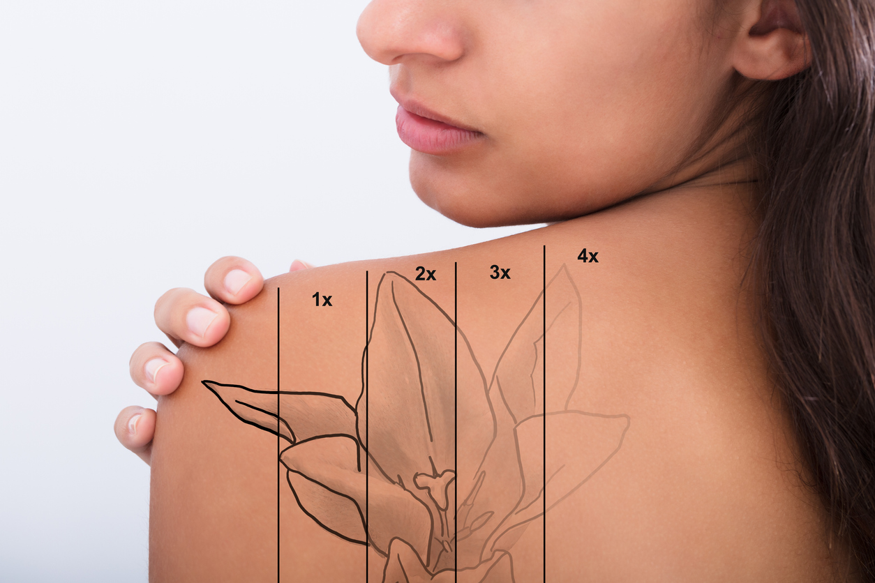 Enlighten Laser Tattoo Removal | Rao Dermatology Enlighten Laser Tattoo Removal | Rao Dermatology