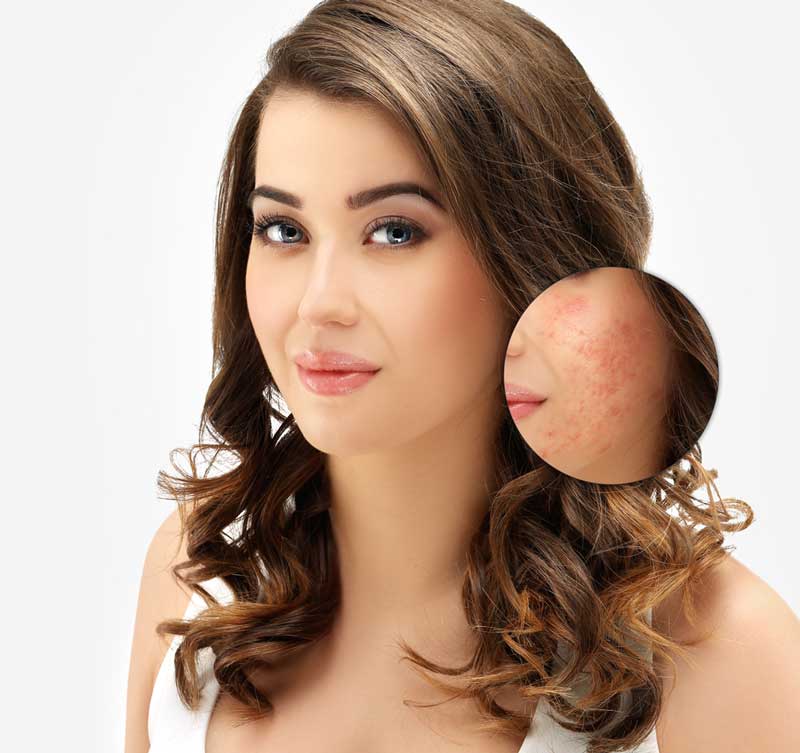 Scars and Scar Tissue: Removal and Treatment - Rao Dermatology Scars and Scar Tissue: Removal and Treatment - Rao Dermatology