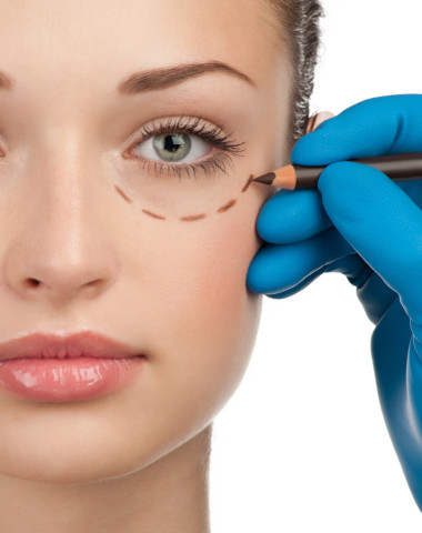 eyelid surgery Edmonton