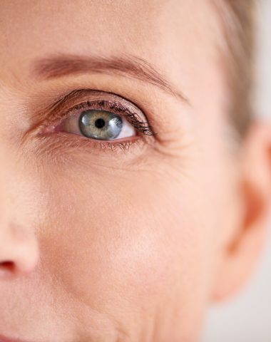 Under Eye Bags & Dark Circles - Rao Dermatology