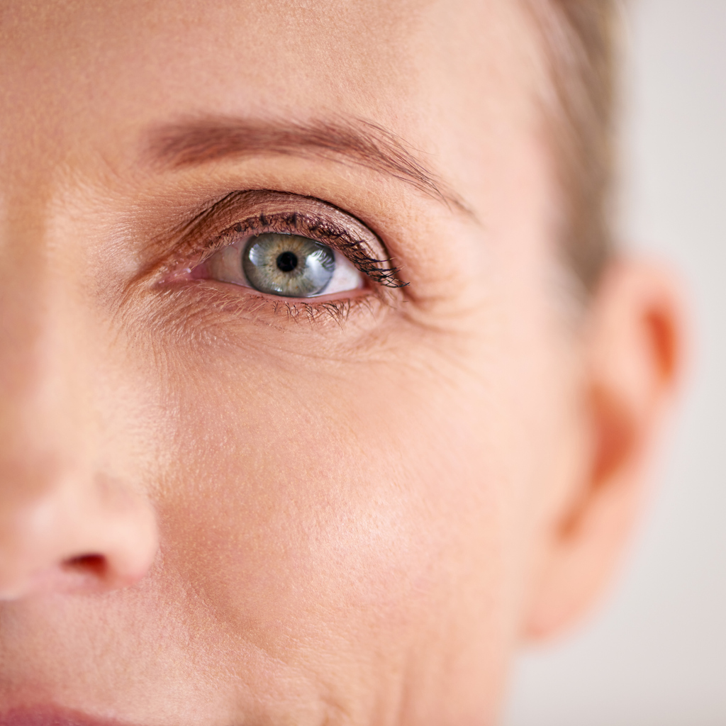 Under Eye Bags & Dark Circles - Rao Dermatology